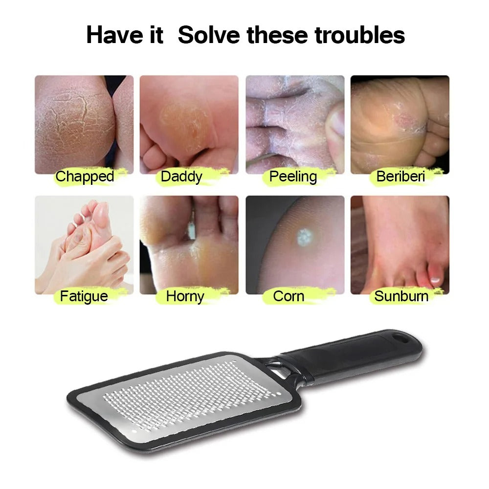 Professional Foot Scrubber Callus Remover Heel File Dead Skin Pedicure Tool